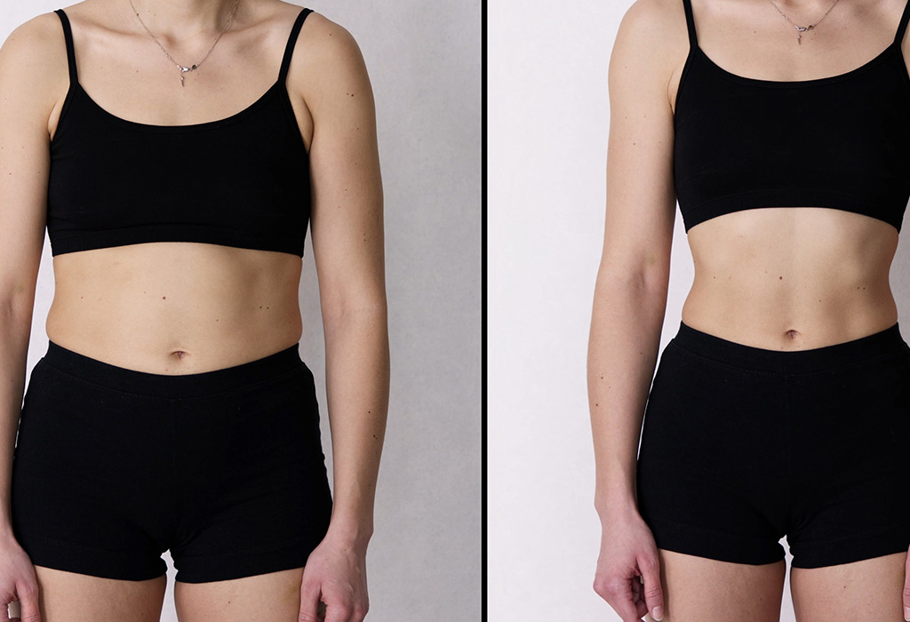 Signature Laser Liposuction Near Florence + Hartsville SC Signature Laser Liposuction Near Florence + Hartsville SC