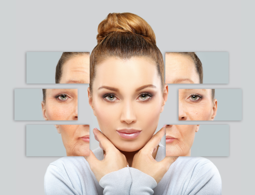 Preventative Botox Under 30