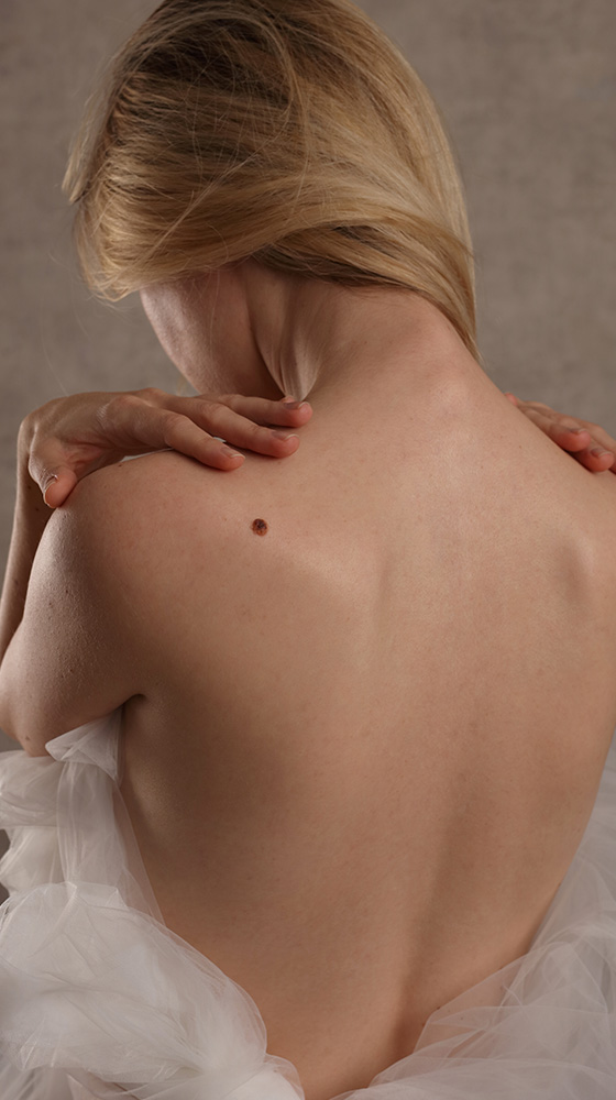 Mole : Tag Removal Mole / Tag Removal