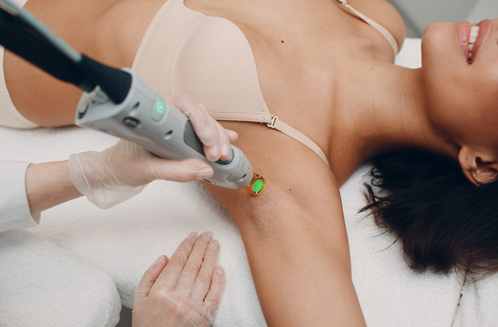 Painless Laser Hair Removal