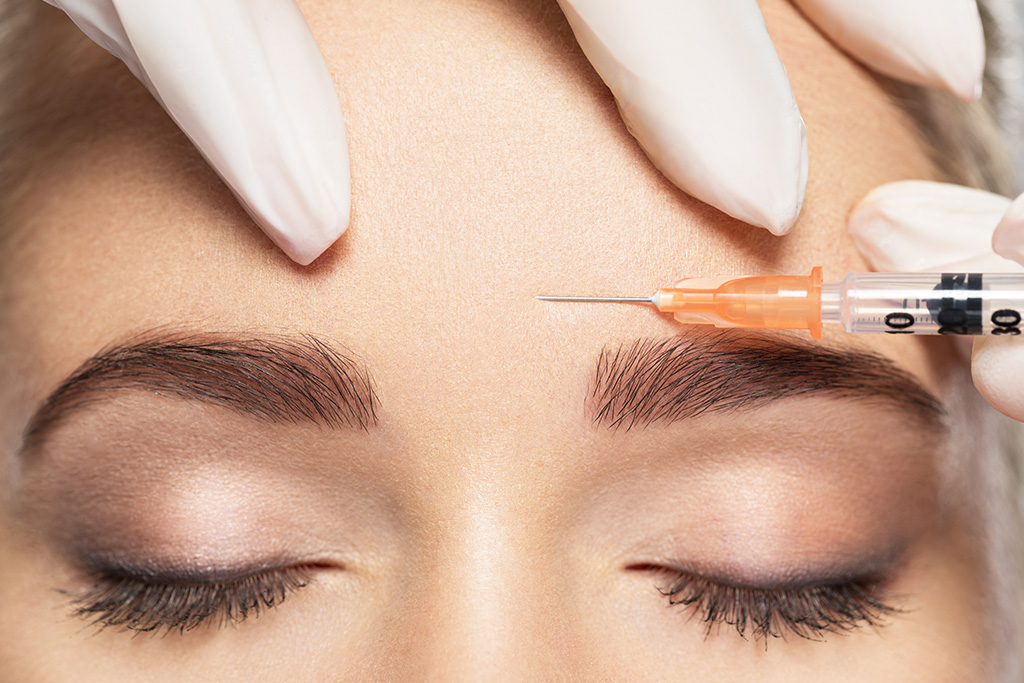 Botox® for Tension & Migraine Management