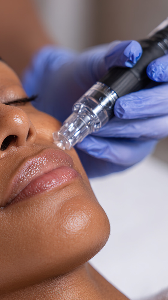 Procell Microchanneling